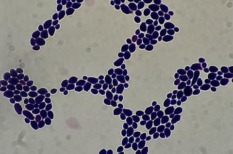 Yeast cells in Gram stain