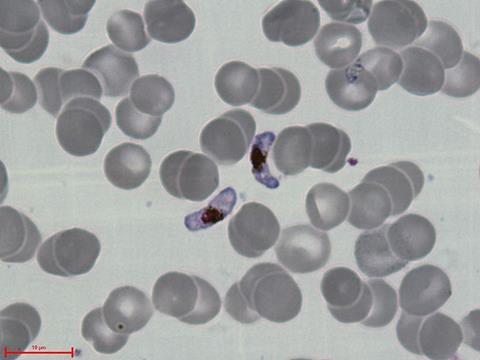 P.falciparum-gametocytes
