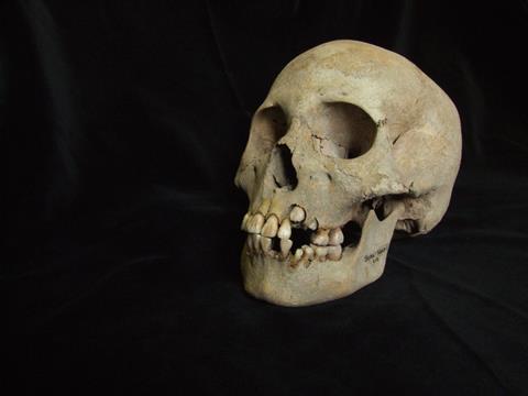 The skull of a 9-11 year old girl