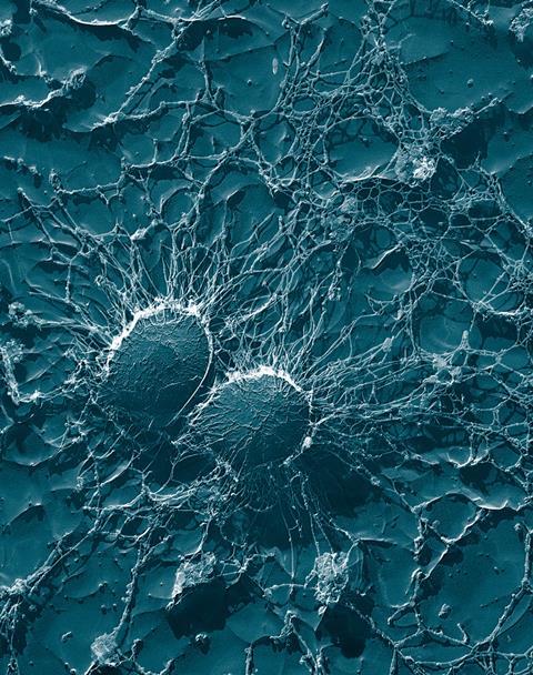 Staphylococcus_aureus,_50,000x,_USDA,_ARS,_EMU