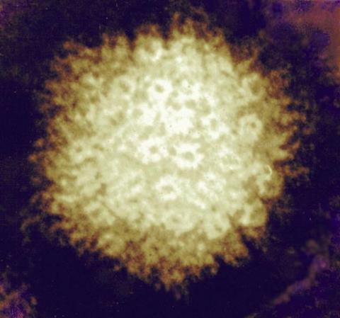 Varicella-zoster_Virus_(5614251360)