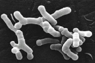 Bifidobacterium_longum_en_microscopie_électronique
