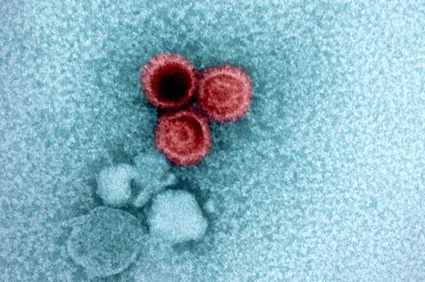 Epstein-Barr_Virus_(EBV)_Particles_-_53583885254