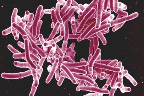 Mycobacterium_tuberculosis_Bacteria,_the_Cause_of_TB_(5149398656)