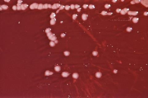Pseudomonas_aeruginosa_01