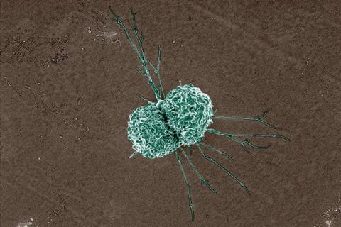 Macrophage_(17195150690)