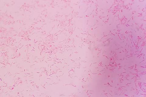 Capnocytophaga_canimorsus_gram_stain