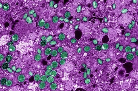 Mpox_Virus_-_53922109282