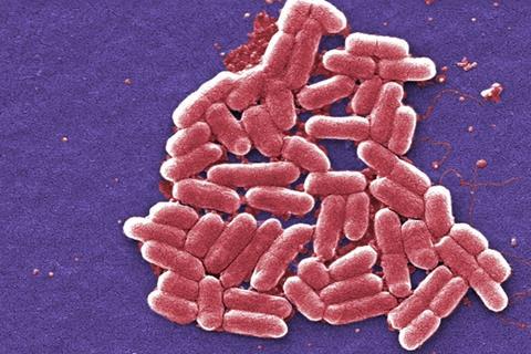 Escherichia_coli_electron_microscopy