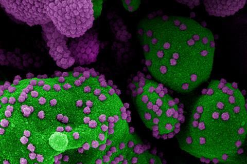 Novel_Coronavirus_SARS-Cov-2_(50011008502)