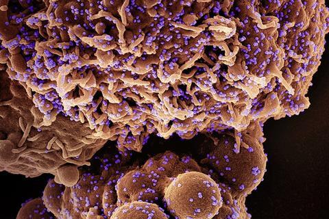 Novel_Coronavirus_SARS-CoV-2_(Omicron)_(52691360959) (1)
