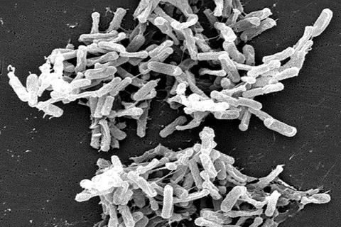 Clostridium_difficile_01