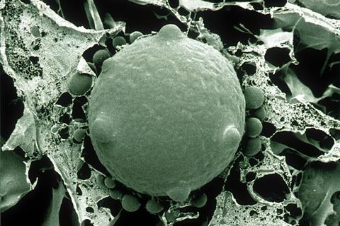 CSIRO_ScienceImage_1392_Scanning_Electron_Micrograph_of_Chytrid_Fungus