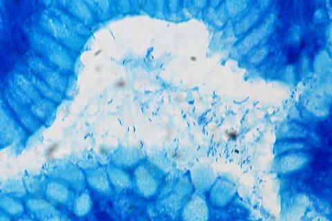 Helicobacter_pylori,_Gastric_Biopsy,_Giemsa_Stain_(5517582111)