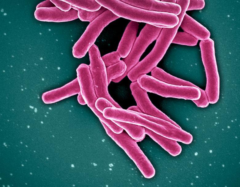 Common cell-death inhibitor reveals an unexpected pathway in ...